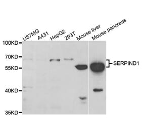 Western blot - SERPIND1 Antibody from Signalway Antibody (33086) - Antibodies.com