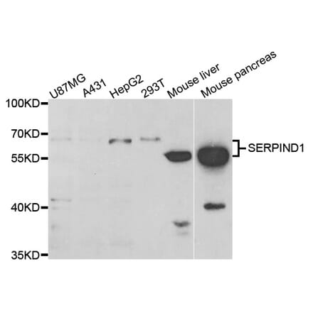 Western blot - SERPIND1 Antibody from Signalway Antibody (33086) - Antibodies.com