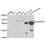 Western blot - SERPIND1 Antibody from Signalway Antibody (33086) - Antibodies.com