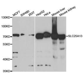 Western blot - SLC25A13 Antibody from Signalway Antibody (33087) - Antibodies.com