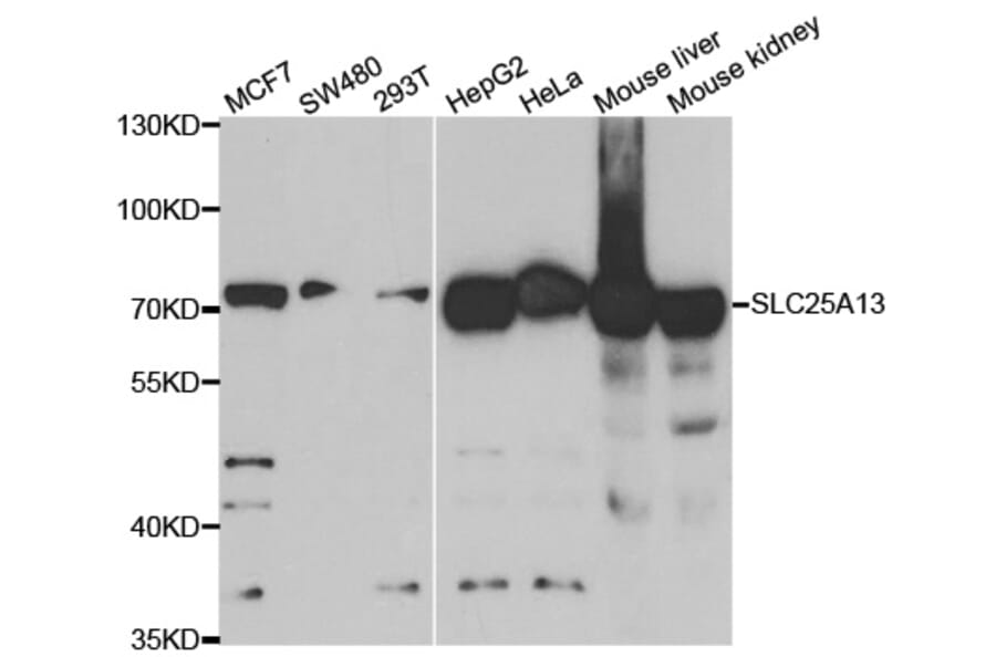 Western blot - SLC25A13 Antibody from Signalway Antibody (33087) - Antibodies.com
