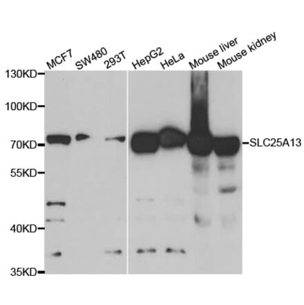 Western blot - SLC25A13 Antibody from Signalway Antibody (33087) - Antibodies.com