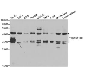 Western blot - TNFSF13B Antibody from Signalway Antibody (33095) - Antibodies.com