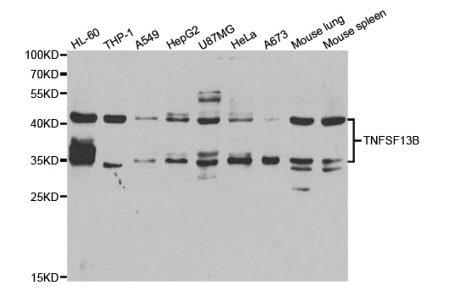 Western blot - TNFSF13B Antibody from Signalway Antibody (33095) - Antibodies.com