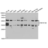 Western blot - TNFSF13B Antibody from Signalway Antibody (33095) - Antibodies.com