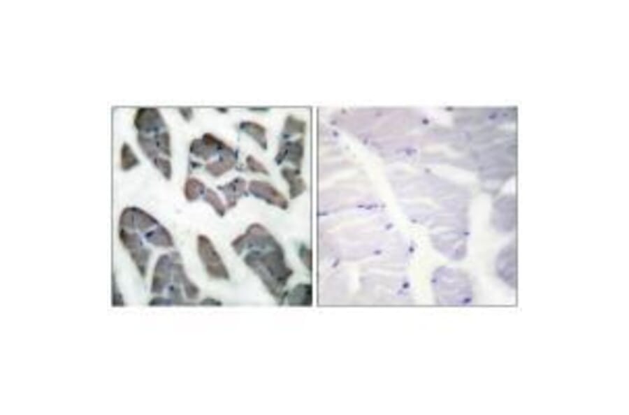 Immunohistochemistry - Actin-γ2 Antibody from Signalway Antibody (33320) - Antibodies.com