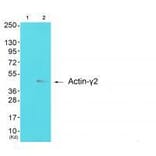Western blot - Actin-γ2 Antibody from Signalway Antibody (33320) - Antibodies.com