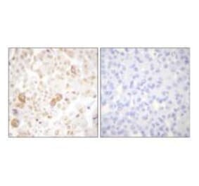 Immunohistochemistry - Cyclin F Antibody from Signalway Antibody (33352) - Antibodies.com