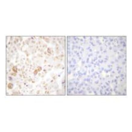 Immunohistochemistry - Cyclin F Antibody from Signalway Antibody (33352) - Antibodies.com