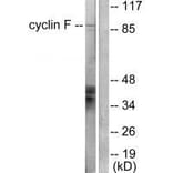 Western blot - Cyclin F Antibody from Signalway Antibody (33352) - Antibodies.com