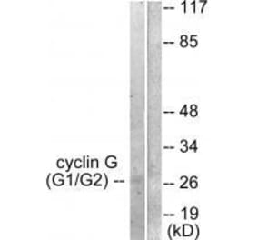 Western blot - Cyclin G Antibody from Signalway Antibody (33353) - Antibodies.com