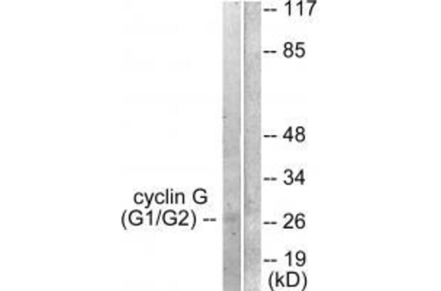 Western blot - Cyclin G Antibody from Signalway Antibody (33353) - Antibodies.com