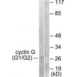 Western blot - Cyclin G Antibody from Signalway Antibody (33353) - Antibodies.com
