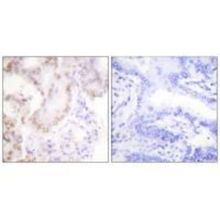 Immunohistochemistry - Cyclin G Antibody from Signalway Antibody (33353) - Antibodies.com