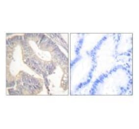 Immunohistochemistry - Gastrin Antibody from Signalway Antibody (33384) - Antibodies.com