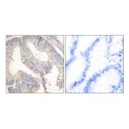 Immunohistochemistry - Gastrin Antibody from Signalway Antibody (33384) - Antibodies.com