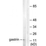 Western blot - Gastrin Antibody from Signalway Antibody (33384) - Antibodies.com