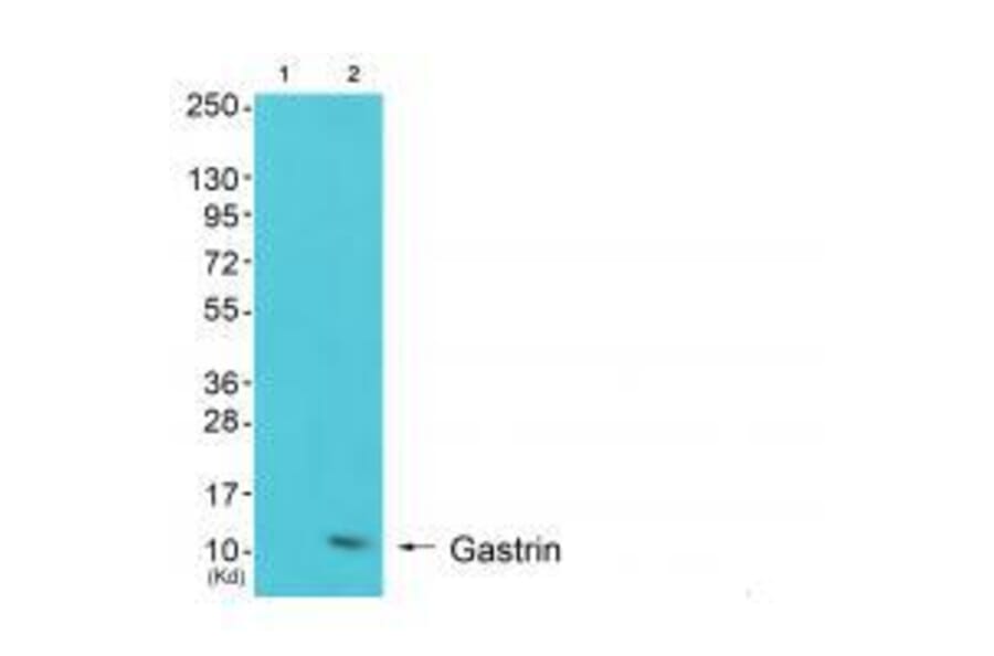 Western blot - Gastrin Antibody from Signalway Antibody (33384) - Antibodies.com