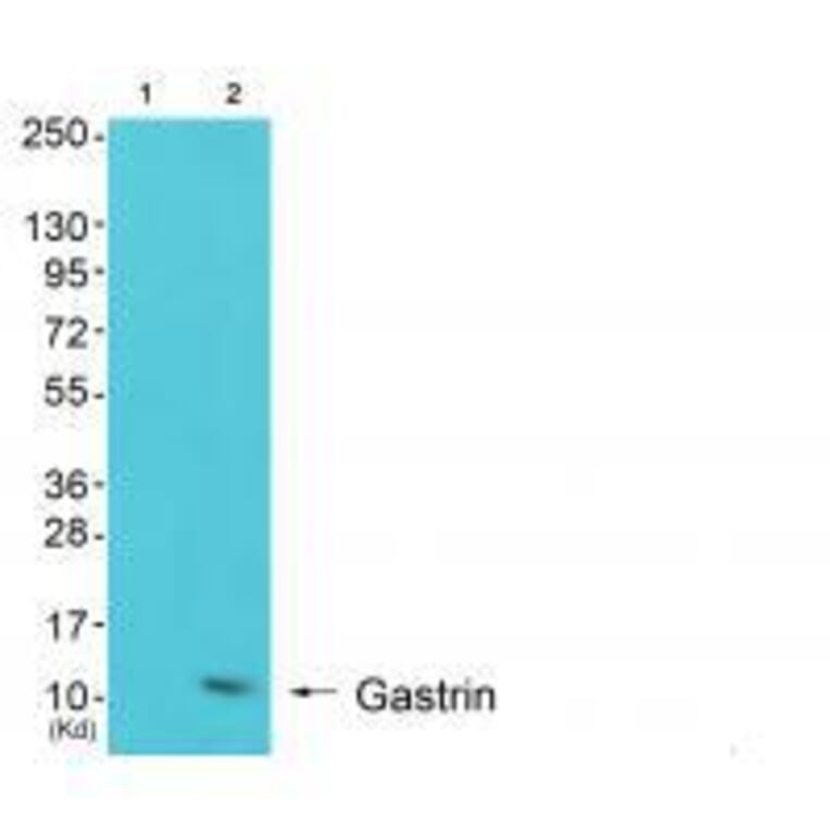 Western blot - Gastrin Antibody from Signalway Antibody (33384) - Antibodies.com