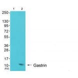 Western blot - Gastrin Antibody from Signalway Antibody (33384) - Antibodies.com