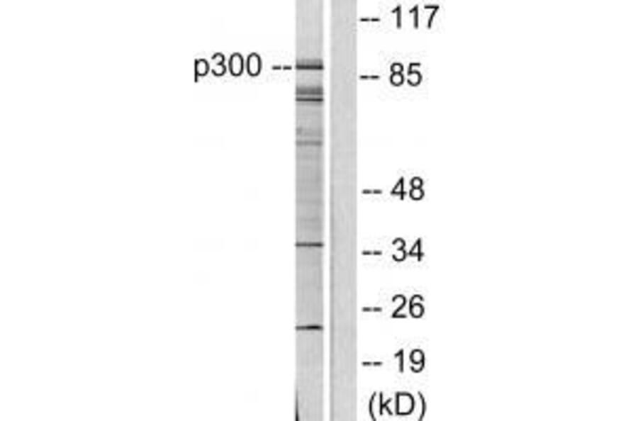 Western blot - P300/CBP Antibody from Signalway Antibody (33460) - Antibodies.com