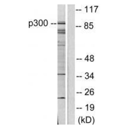 Western blot - P300/CBP Antibody from Signalway Antibody (33460) - Antibodies.com