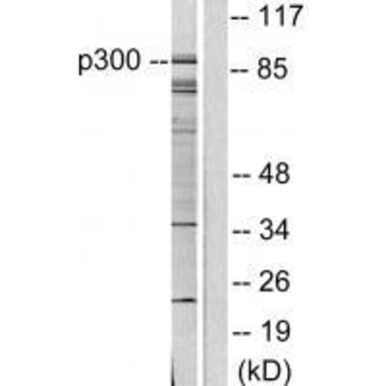 Western blot - P300/CBP Antibody from Signalway Antibody (33460) - Antibodies.com