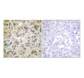 Immunohistochemistry - Vimentin Antibody from Signalway Antibody (33541) - Antibodies.com
