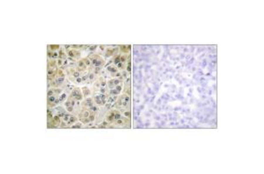 Immunohistochemistry - Vimentin Antibody from Signalway Antibody (33541) - Antibodies.com