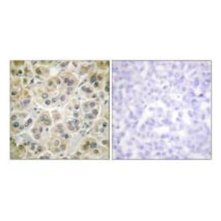 Immunohistochemistry - Vimentin Antibody from Signalway Antibody (33541) - Antibodies.com