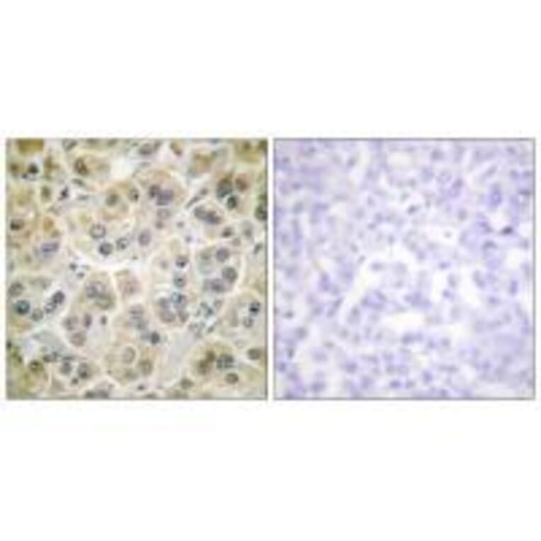 Immunohistochemistry - Vimentin Antibody from Signalway Antibody (33541) - Antibodies.com