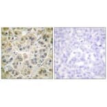 Immunohistochemistry - Vimentin Antibody from Signalway Antibody (33541) - Antibodies.com