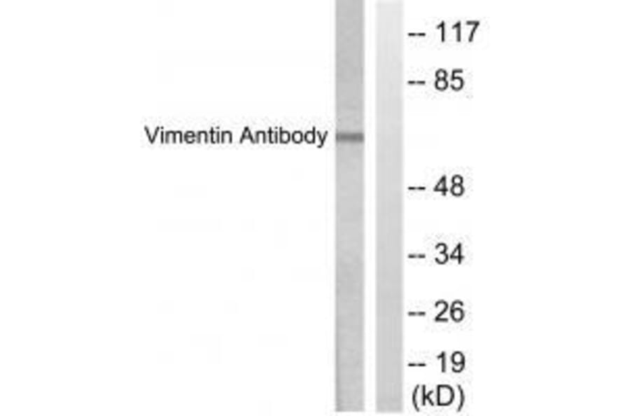Western blot - Vimentin Antibody from Signalway Antibody (33541) - Antibodies.com