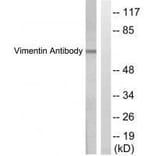 Western blot - Vimentin Antibody from Signalway Antibody (33541) - Antibodies.com