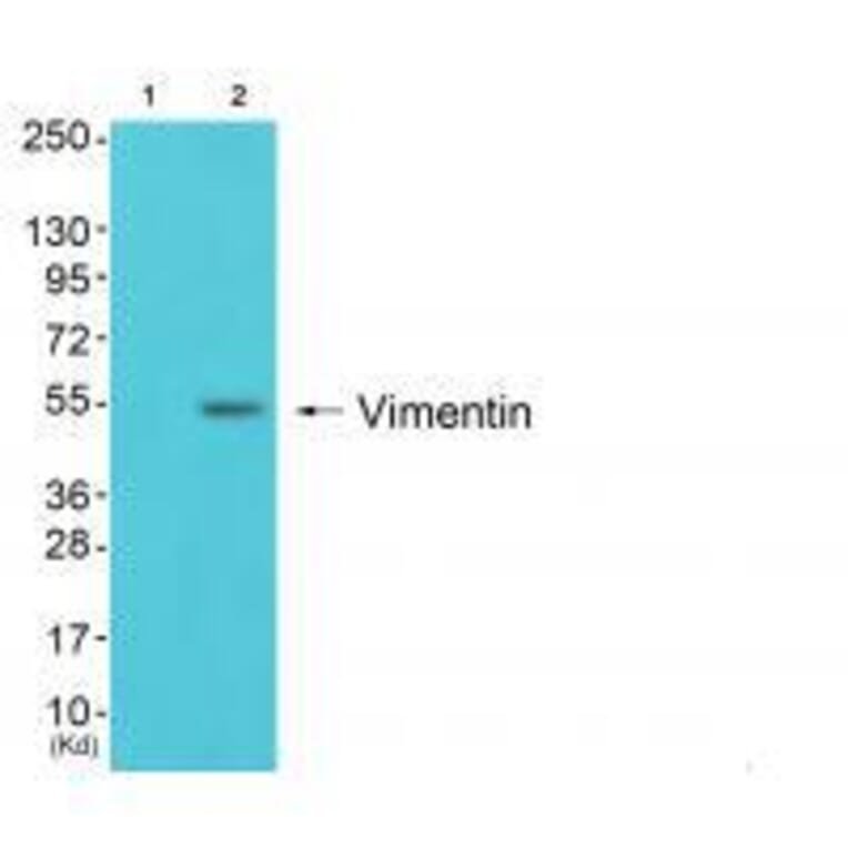 Western blot - Vimentin Antibody from Signalway Antibody (33541) - Antibodies.com