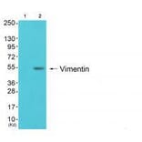 Western blot - Vimentin Antibody from Signalway Antibody (33541) - Antibodies.com