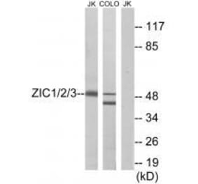 Western blot - ZIC1/2/3 Antibody from Signalway Antibody (33598) - Antibodies.com