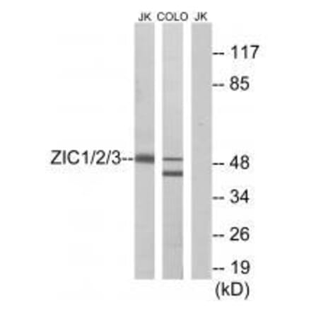 Western blot - ZIC1/2/3 Antibody from Signalway Antibody (33598) - Antibodies.com