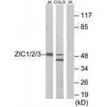 Western blot - ZIC1/2/3 Antibody from Signalway Antibody (33598) - Antibodies.com