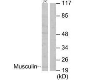 Western blot - Musculin Antibody from Signalway Antibody (33603) - Antibodies.com
