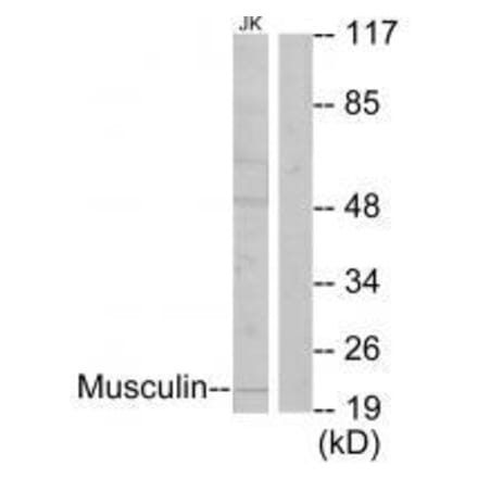 Western blot - Musculin Antibody from Signalway Antibody (33603) - Antibodies.com