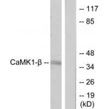 Western blot - CaMK1-β Antibody from Signalway Antibody (33936) - Antibodies.com