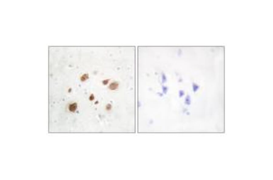 Immunohistochemistry - CaMK1-β Antibody from Signalway Antibody (33936) - Antibodies.com