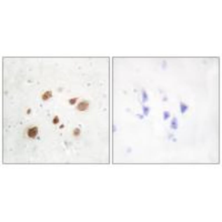 Immunohistochemistry - CaMK1-β Antibody from Signalway Antibody (33936) - Antibodies.com