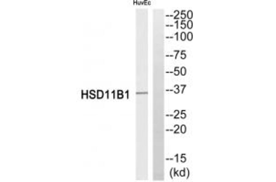 Western blot - HSD11B1 Antibody from Signalway Antibody (34623) - Antibodies.com