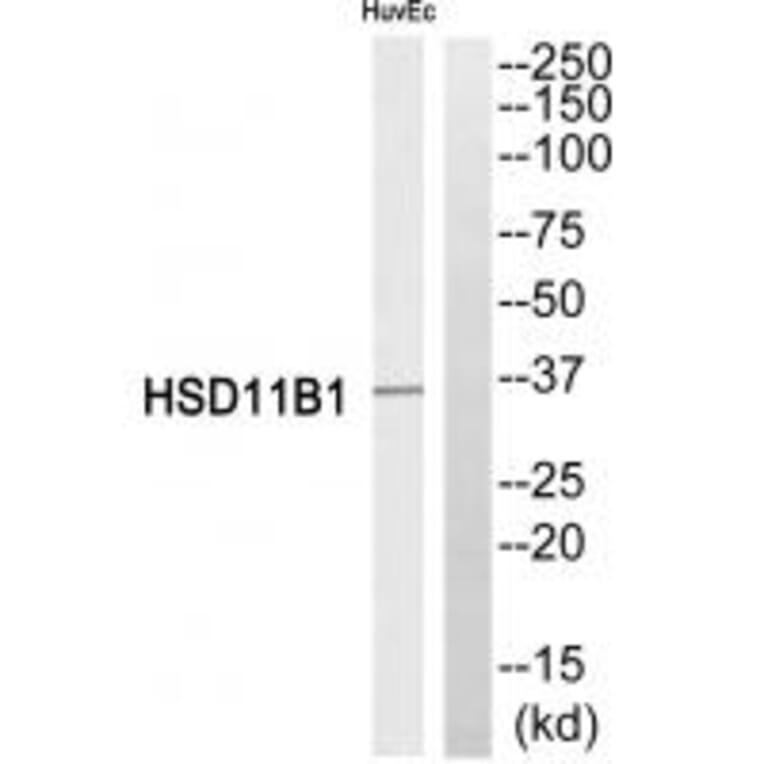 Western blot - HSD11B1 Antibody from Signalway Antibody (34623) - Antibodies.com