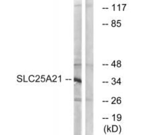 Western blot - SLC25A21 Antibody from Signalway Antibody (34799) - Antibodies.com