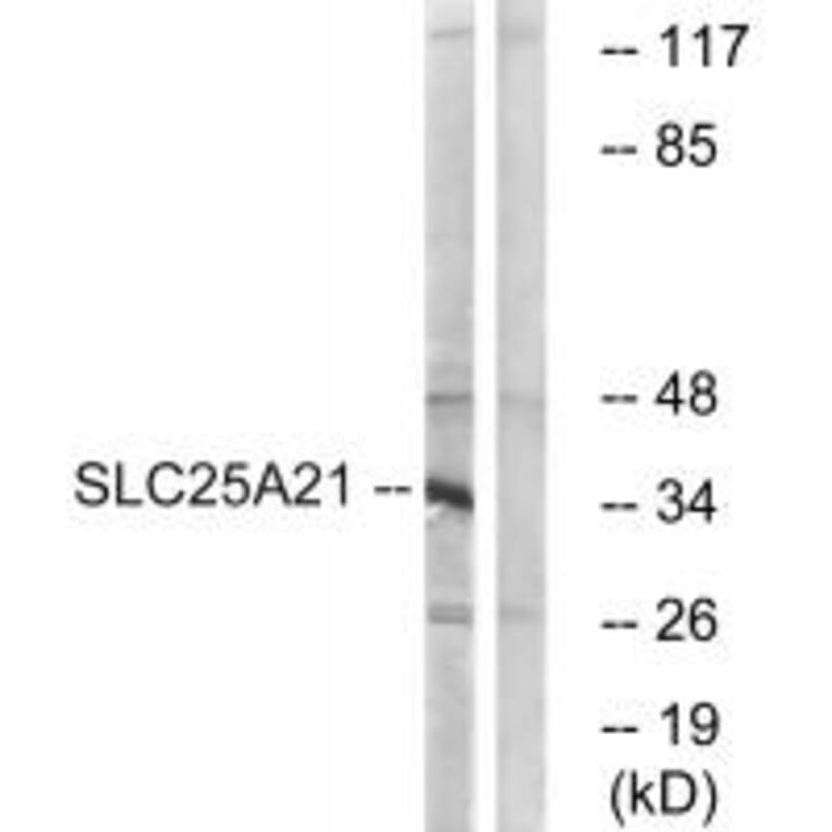 Western blot - SLC25A21 Antibody from Signalway Antibody (34799) - Antibodies.com