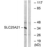 Western blot - SLC25A21 Antibody from Signalway Antibody (34799) - Antibodies.com
