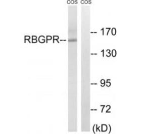 Western blot - RAB3GAP2 Antibody from Signalway Antibody (34951) - Antibodies.com